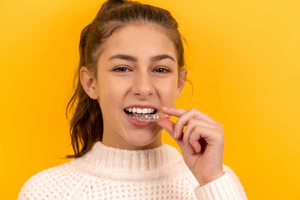 Patient fitting a clear Invisalign aligner over her teeth