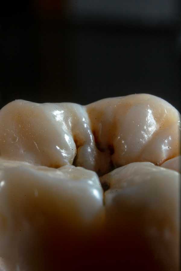 Macro detail of tooth enamel and surface texture